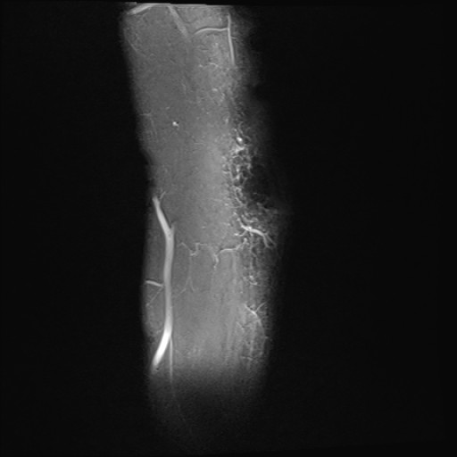 Click on the Serie image to view the images of Wieszt, Gnter